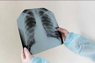 Туберкулез у студента ВБМК: учащихся перевели на дистанционное обучение